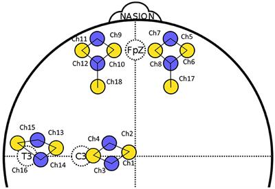 Exploring the Brain Activity Related to Missing Penalty Kicks: An fNIRS Study